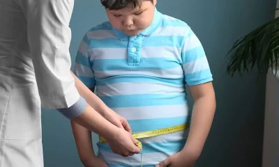 چاقی در کودکان